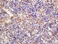 CSDE1 Polyclonal Antibody